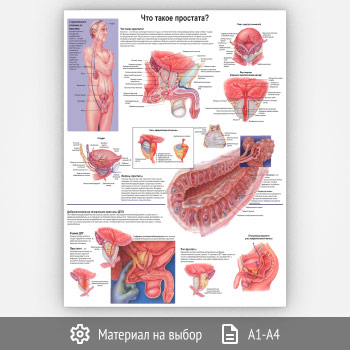 Плакат «Что такое простата?» (ЗОЖ-47, 1 лист)